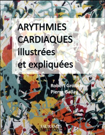 Image de ARYTHMIES CARDIAQUES ILLUSTREES ET EXPLIQUEES