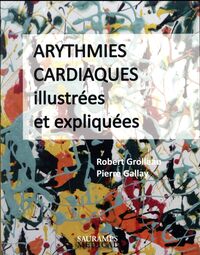 Image de ARYTHMIES CARDIAQUES ILLUSTREES ET EXPLIQUEES