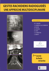 Picture of GESTES RACHIDIENS RADIOGUIDES-UNE APPROCHE