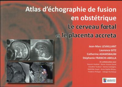 Picture of LE CERVEAU FOETAL ET LE PLACENTA ACCRETA. ATLAS D ECHOGRAPHIE DE FUSION EN GYNEC