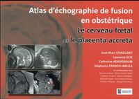 Picture of LE CERVEAU FOETAL ET LE PLACENTA ACCRETA. ATLAS D ECHOGRAPHIE DE FUSION EN GYNEC