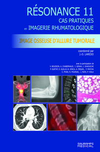 Image de Résonance 11 - Imagerie osseuse d'allure tumorale