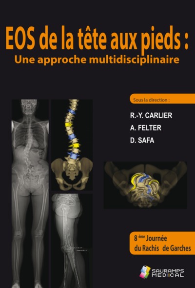 Image de EOS DE LA TETE AUX PIEDS : UNE APPROCHE MULTIDISCIPLINAIRE