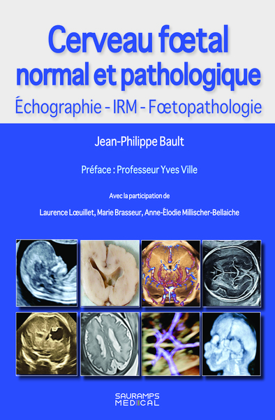 Picture of Cerveau foetal normal et pathologique -Echographie, IRM, Foetopathologie