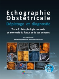 Picture of ECHOGRAPHIE OBSTETRICALE. DEPISTAGE ET DIAGNOSTIC T2-MORPHOLOGIE NORMALE & ANORM