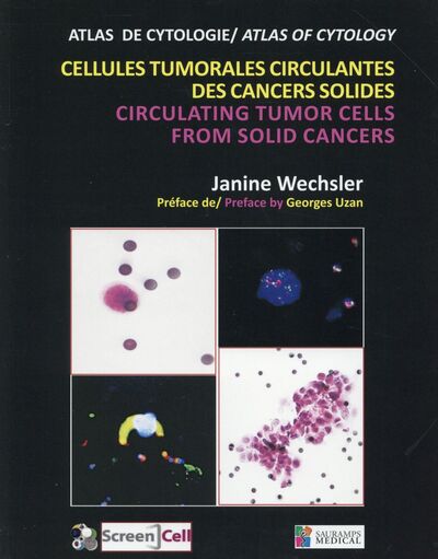 Image de CELLULES TUMORALES CIRCULANTES DES CANCERS SOLIDES - CIRCULATING TUMOR CELLS FRO