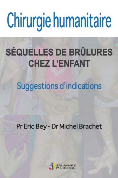 Picture of CHIRURGIE HUMANITAIRE. SEQUELLES DE BRULURES CHEZ L ENFANT