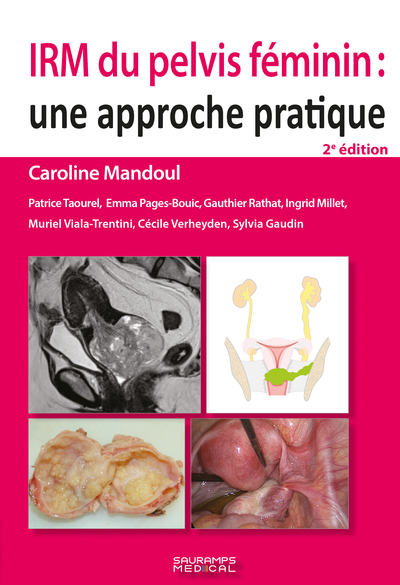 Picture of IRM du pelvis féminin 2e ED