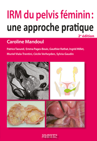 Picture of IRM du pelvis féminin 2e ED