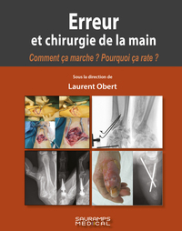 Image de Erreur et chirurgie de la main