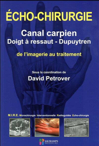 Picture of ECHO-CHIRURGIE CANAL CARPIEN, DOIGT A RESSAUT ET DUPUYTREN