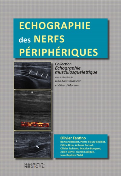 Picture of ECHOGRAPHIE DES NERFS PERIPHERQUES