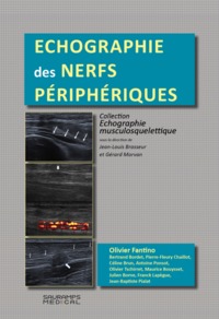 Picture of ECHOGRAPHIE DES NERFS PERIPHERQUES