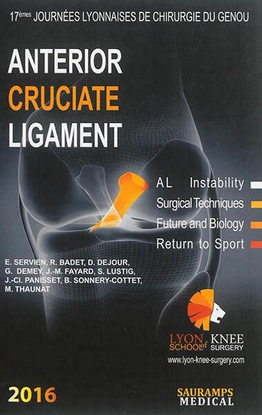 Picture of ANTERIOR CRUCIATE LIGAMENT