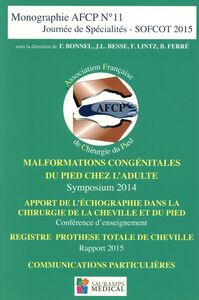 Picture of MALFORMATIONS CONGENITALES DU PIED CHEZ L ADULTE-AFCP N 11