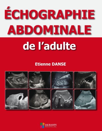 Image de ECHOGRAPHIE ABDOMINALE DE L ADULTE