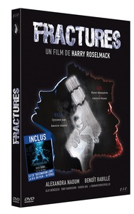 Picture of FRACTURES