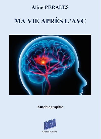 Image de Ma vie après l'AVC