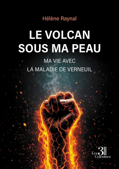 Image de Le volcan sous ma peau