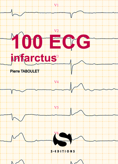 Picture of 100 ECG autour de l'infarctus
