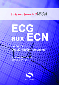 Image de ECG aux ECN