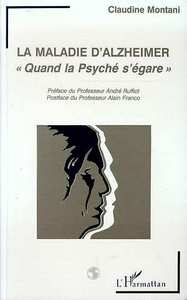 Image de La maladie d'alzheimer