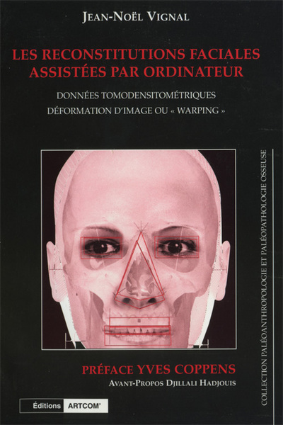 Picture of Les Reconstitutions Faciales Assistées Par Ordinateur