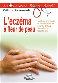 Image de L'eczéma à fleur de peau