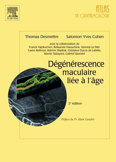 Picture of Dégénérescence maculaire liée à l'âge