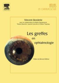 Picture of Les greffes en ophtalmologie