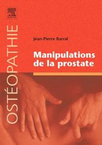Picture of Manipulations de la prostate