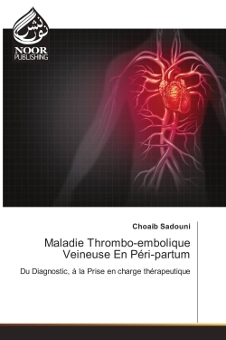 Image de Maladie Thrombo-embolique Veineuse En Péri-partum