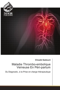 Image de Maladie Thrombo-embolique Veineuse En Péri-partum