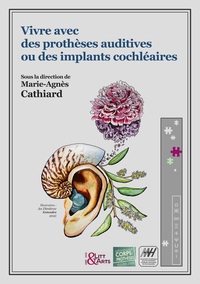 Image de Vivre avec des prothèses auditives ou des implants cochléaires