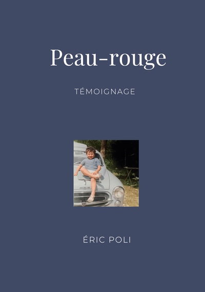 Picture of Peau-rouge
