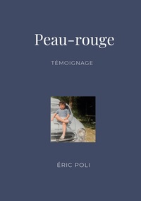 Picture of Peau-rouge