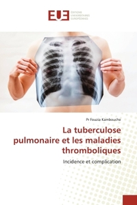 Picture of La tuberculose pulmonaire et les maladies thromboliques