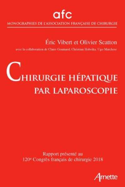 Image de Chirurgie hépatique par laparoscopie