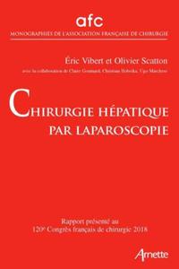 Image de Chirurgie hépatique par laparoscopie
