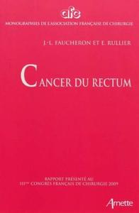 Image de CANCER DU RECTUM