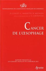 Image de CANCER DE L'OESOPHAGE