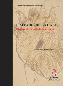 Picture of L'affaire de la gale