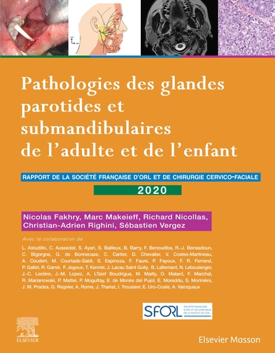 Picture of Pathologies des glandes parotides et submandibulaires de l'adulte et de l'enfant