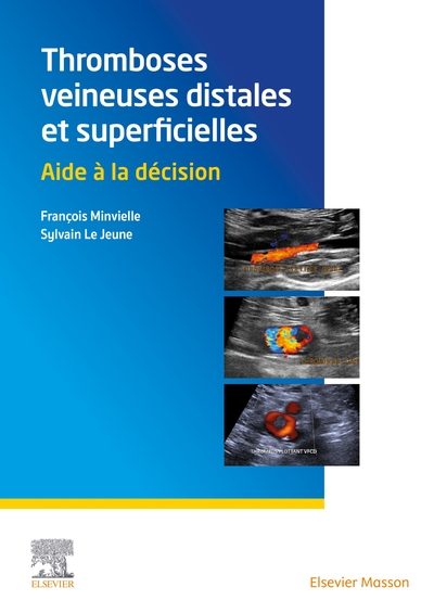 Picture of Thromboses veineuses distales et superficielles