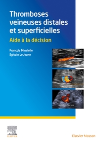 Picture of Thromboses veineuses distales et superficielles