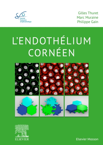 Picture of L'endothélium cornéen