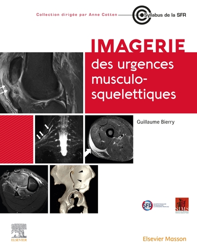Image de Imagerie des urgences musculosquelettiques