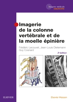 Image de Imagerie de la colonne vertébrale et de la moelle épinière