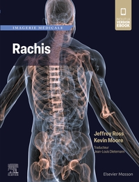 Picture of Imagerie médicale : Rachis