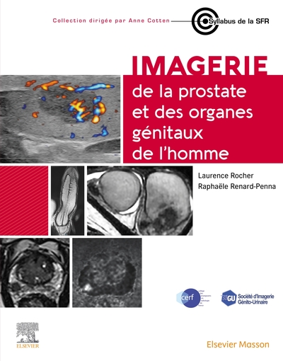 Picture of Imagerie de la prostate et des organes génitaux de l'homme